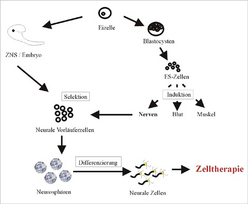 Stammzellen für die Behandlung neurodegenerativer Erkrankungen